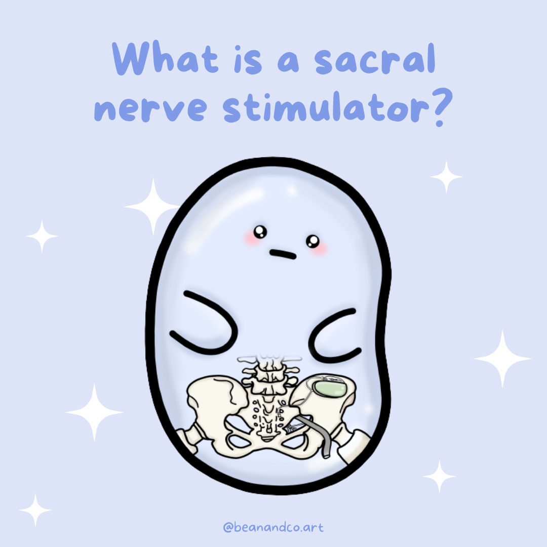 What is a sacral nerve stimulator?