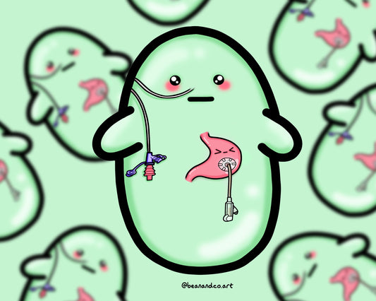 NG/NJ tube and G tube bean sticker- 5cm gloss sticker- stomach/ gastroparesis- feeding tube