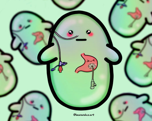 NG/NJ tube and G tube bean sticker- 5cm rainbow holographic sticker- stomach/ gastroparesis- feeding tube